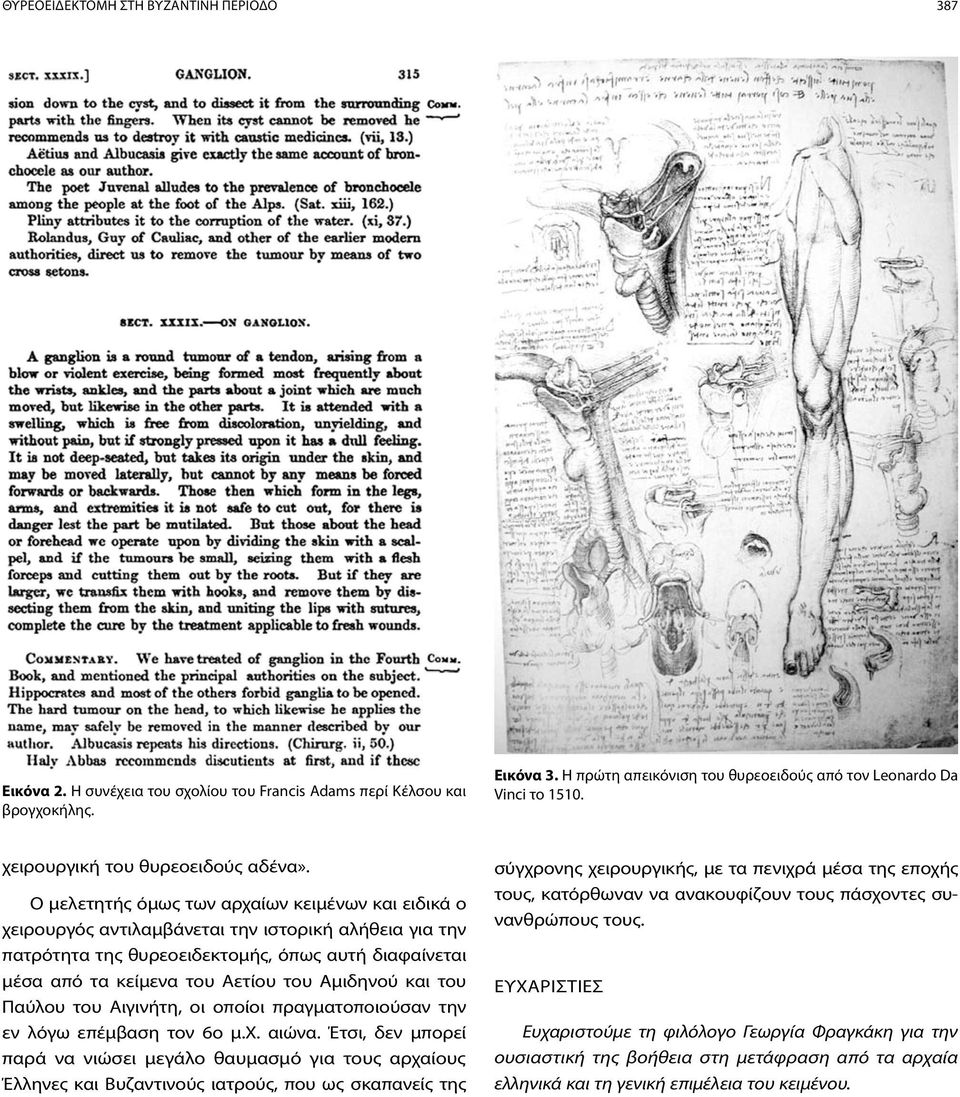 Ο μελετητής όμως των αρχαίων κειμένων και ειδικά ο χειρουργός αντιλαμβάνεται την ιστορική αλήθεια για την πατρότητα της θυρεοειδεκτομής, όπως αυτή διαφαίνεται μέσα από τα κείμενα του Αετίου του