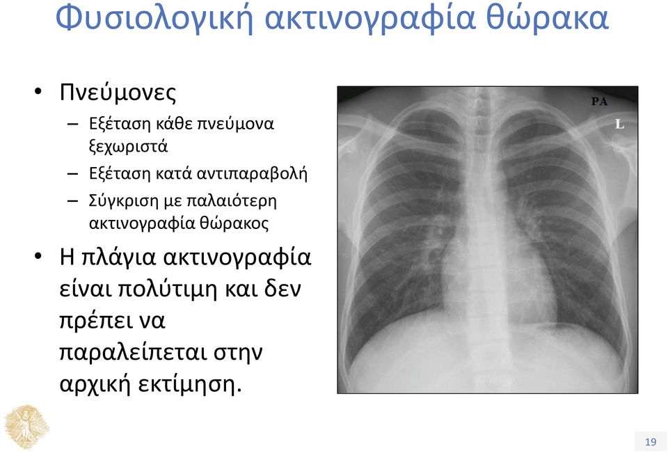 παλαιότερη ακτινογραφία θώρακος Η πλάγια ακτινογραφία