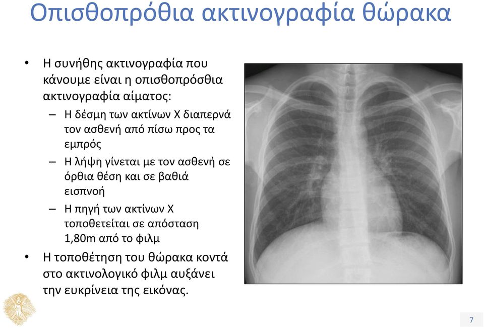 γίνεται με τον ασθενή σε όρθια θέση και σε βαθιά εισπνοή Η πηγή των ακτίνων Χ τοποθετείται σε