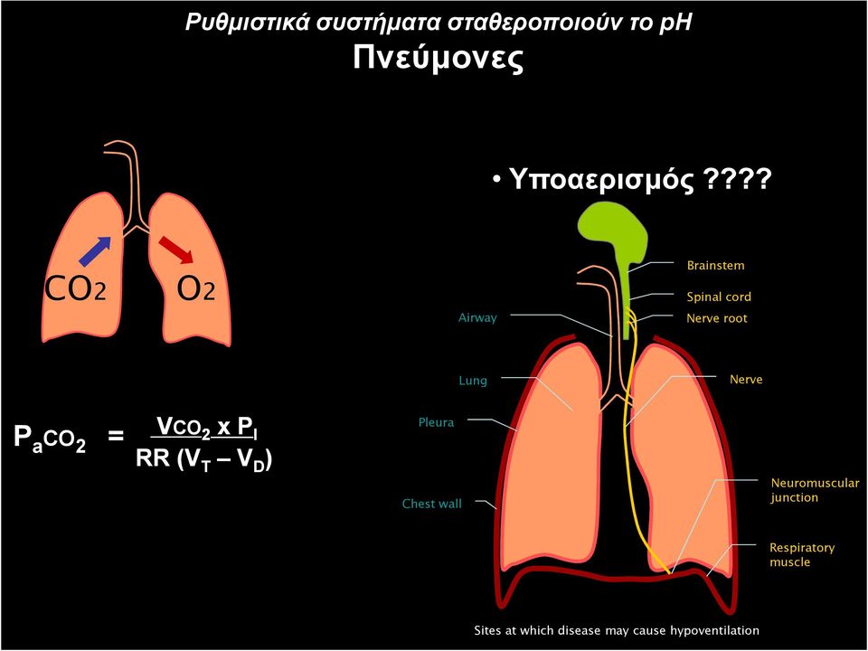 CO 2 = VCO 2 x P I RR (V T V D ) Pleura Chest wall Neuromuscular