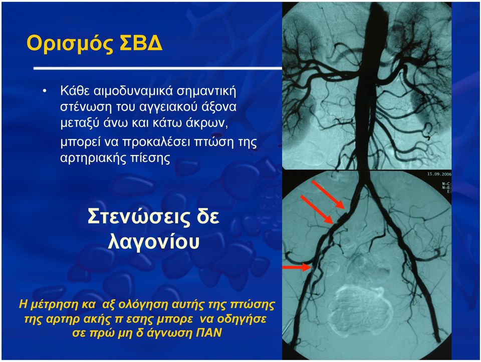 αρτηριακής πίεσης Στενώσεις δε λαγονίου Η µέτρηση και αξιολόγηση