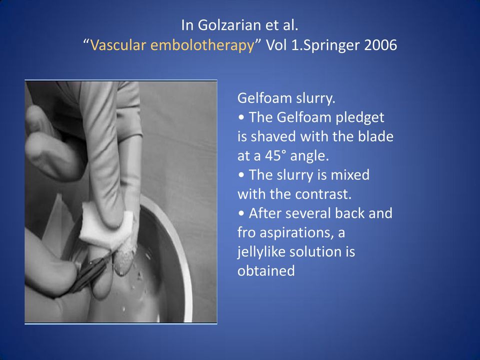 The Gelfoam pledget is shaved with the blade at a 45 angle.