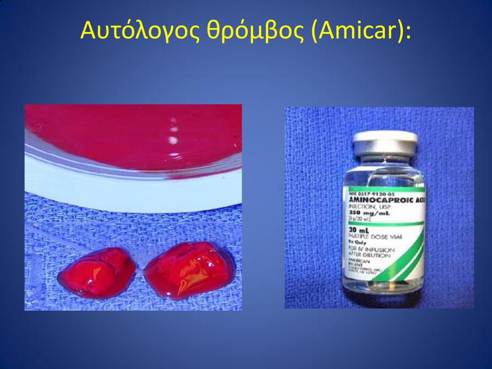 (Amicar):