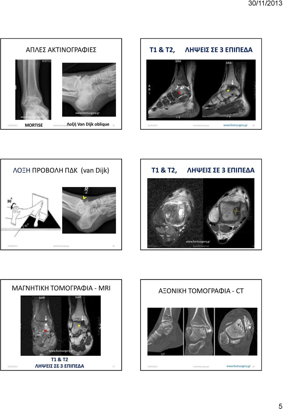 ΛΗΨΕΙΣ ΣΕ 3 ΕΠΙΠΕΔΑ 26 29 ΜΑΓΝΗΤΙΚΗ ΤΟΜΟΓΡΑΦΙΑ - MRI ΑΞΟΝΙΚΗ