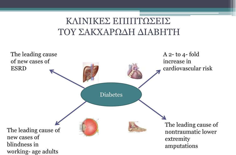 Diabetes The leading cause of new cases of blindness in working-