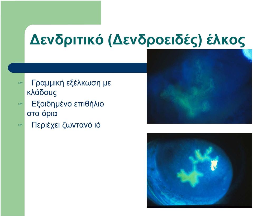 κλάδους Εξοιδημένο