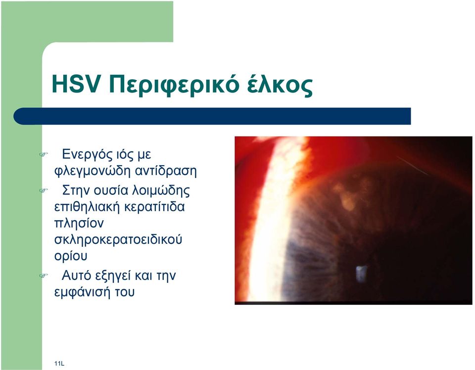 επιθηλιακή κερατίτιδα πλησίον