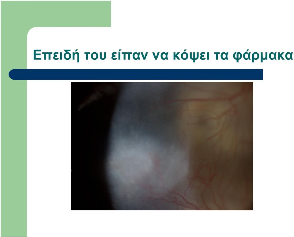 να κόψει