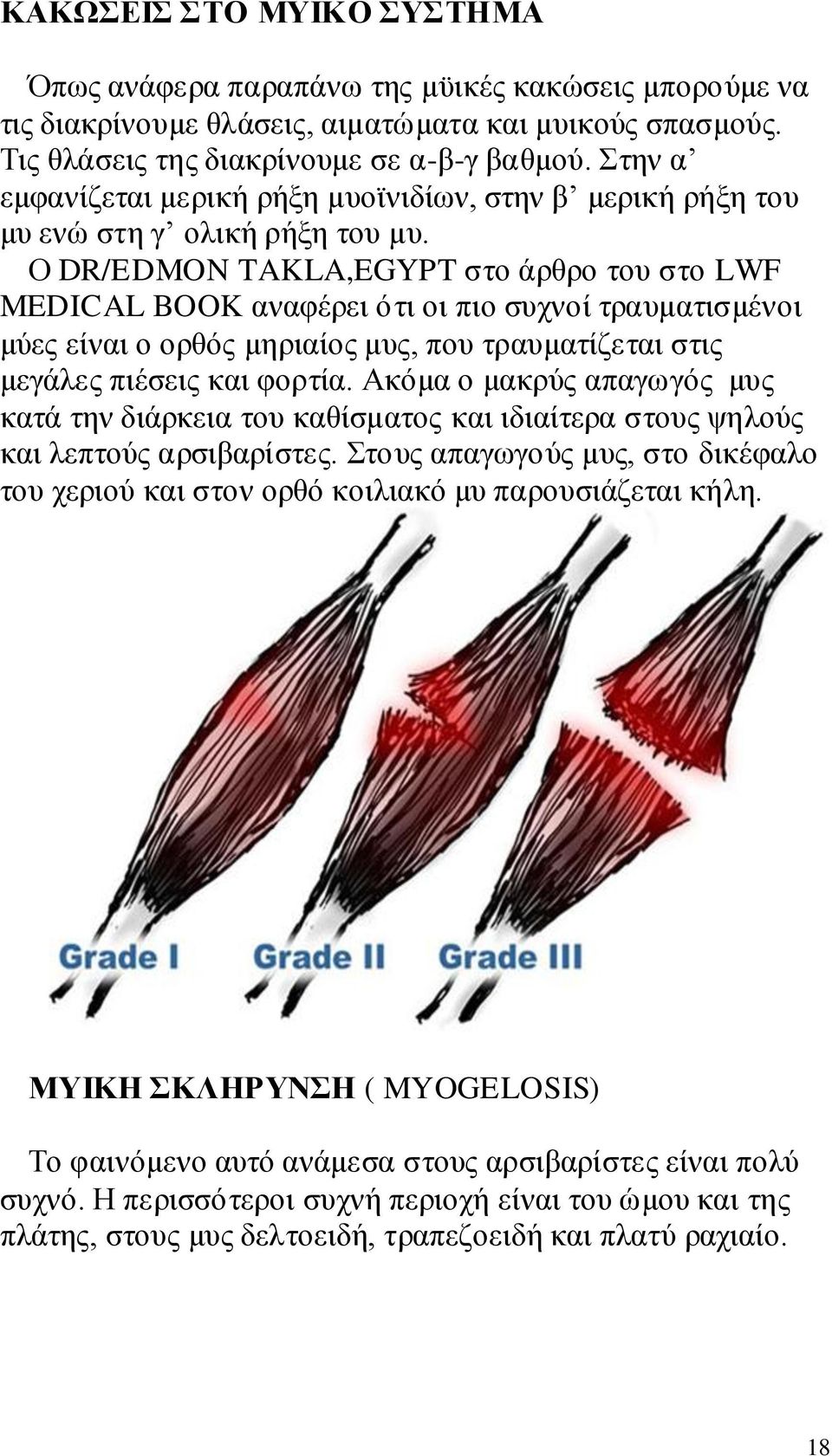 Ο DR/EDMON TAKLA,EGYPT στο άρθρο του στο LWF MEDICAL BOOK αναφέρει ότι οι πιο συχνοί τραυματισμένοι μύες είναι ο ορθός μηριαίος μυς, που τραυματίζεται στις μεγάλες πιέσεις και φορτία.