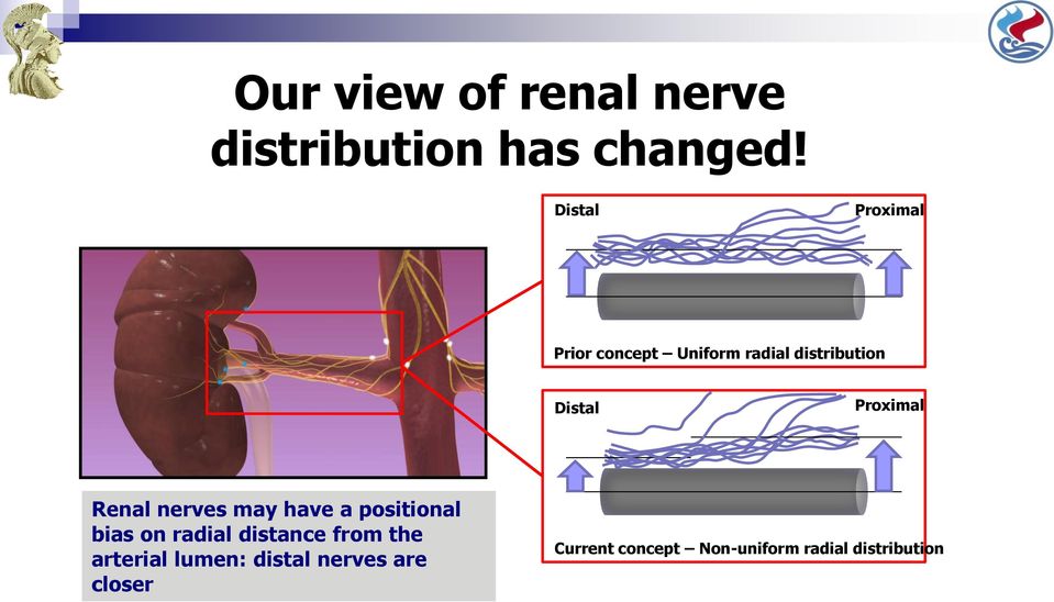 Proximal Renal nerves may have a positional bias on radial distance