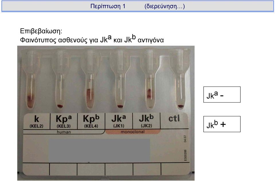 Φαινότυπος ασθενούς για