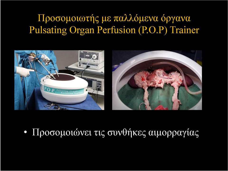 Perfusion (P.O.