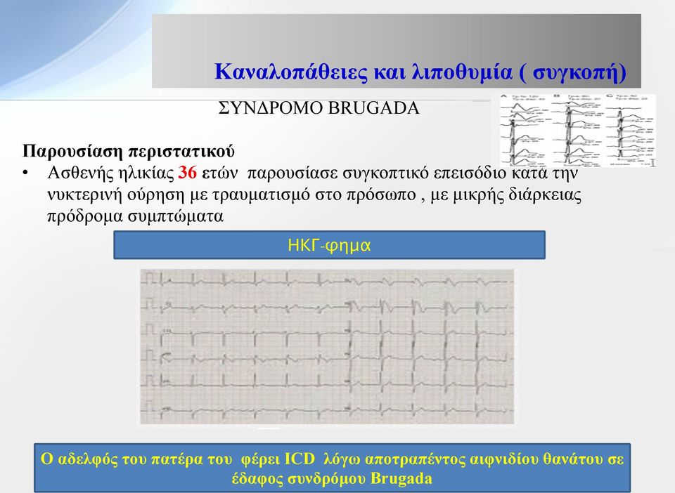 τραυµατισµό στο πρόσωπο, µε µικρής διάρκειας πρόδροµα συµπτώµατα ΗΚΓ-φημα Ο αδελφός