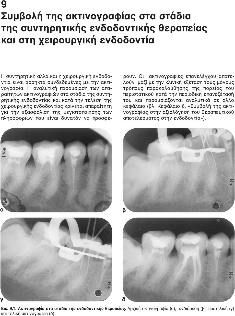 Η αναλυτική παρουσίαση των απαραίτητων ακτινογραφιών στα στάδια της συντηρητικής ενδοδοντίας και κατά την τέλεση της χειρουργικής ενδοδοντίας κρίνεται απαραίτητη για την εξασφάλιση της μεγιστοποίησης