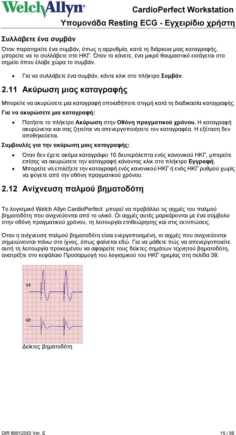 11 Ακύρωση μιας καταγραφής Μπορείτε να ακυρώσετε μια καταγραφή οποιαδήποτε στιγμή κατά τη διαδικασία καταγραφής.