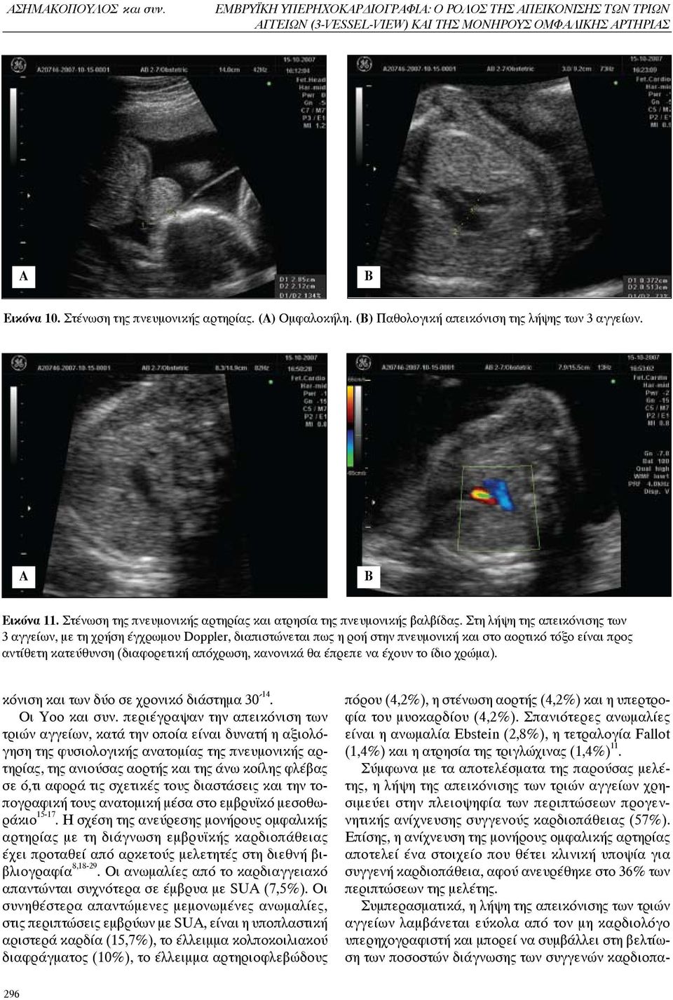 Στη λήψη της απεικόνισης των 3 αγγείων, με τη χρήση έγχρωμου Doppler, διαπιστώνεται πως η ροή στην πνευμονική και στο αορτικό τόξο είναι προς αντίθετη κατεύθυνση (διαφορετική απόχρωση, κανονικά θα
