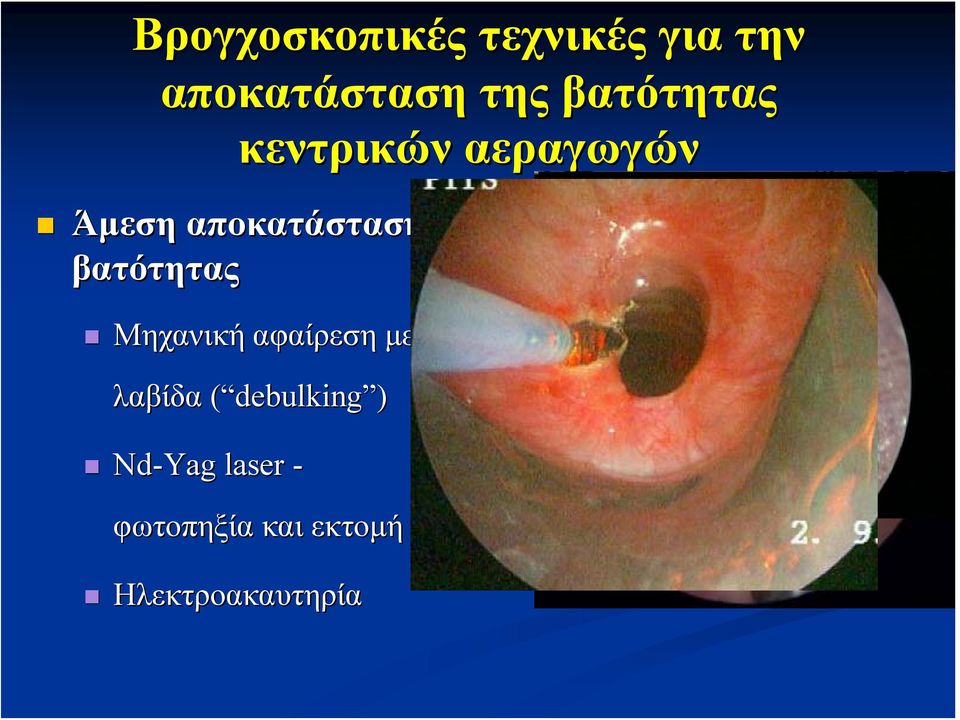 βατότητας Μηχανική αφαίρεση με λαβίδα ( debulking