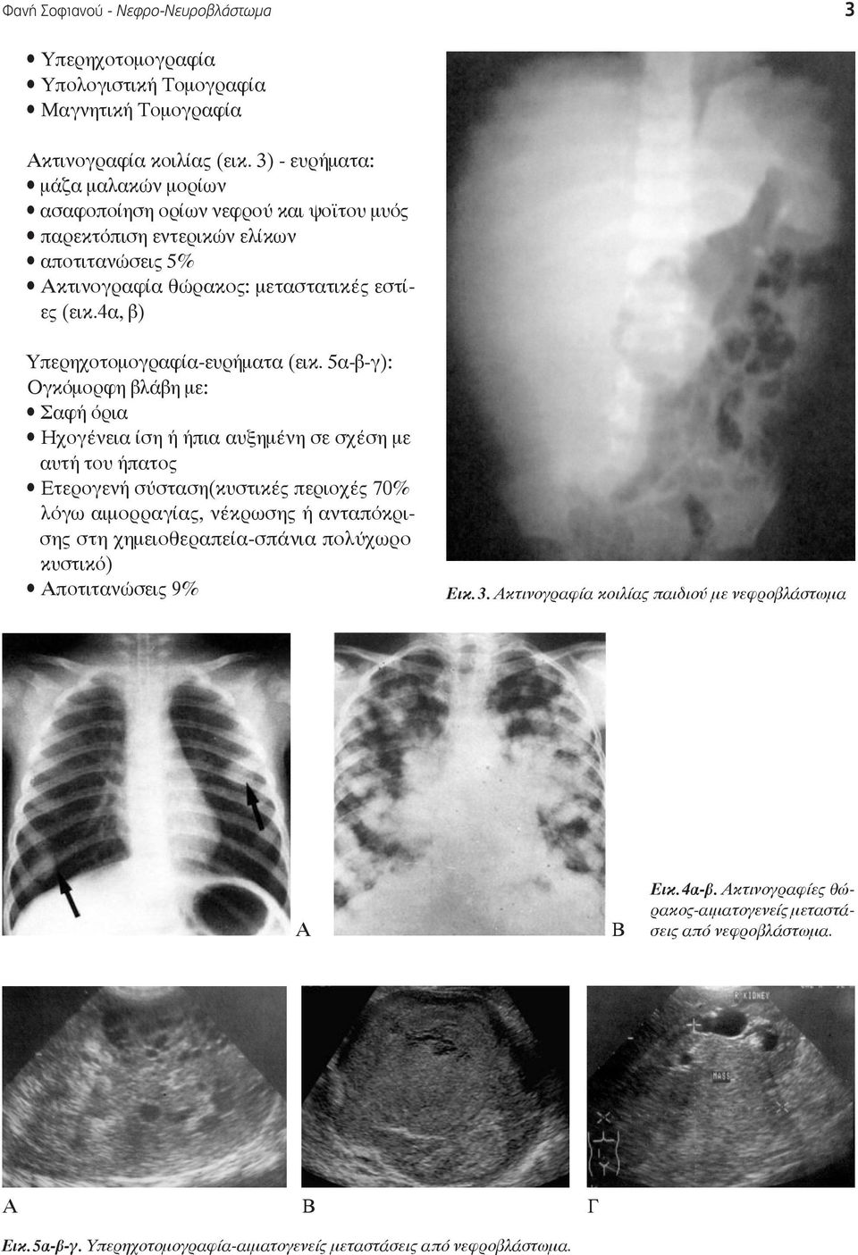 4α, β) Υπερηχοτομογραφία-ευρήματα (εικ.