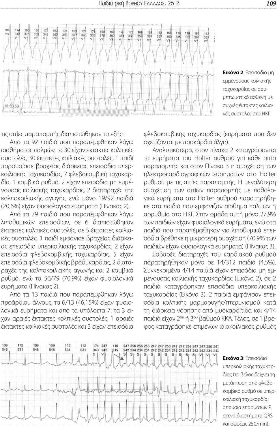 βραχείας διάρκειας επεισόδια υπερκοιλιακής ταχυκαρδίας, 7 φλεβοκομβική ταχυκαρδία, 1 κομβικό ρυθμό, 2 είχαν επεισόδια μη εμμένουσας κοιλιακής ταχυκαρδίας, 2 διαταραχές της κολποκοιλιακής αγωγής, ενώ