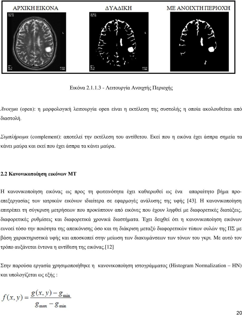 2 Καλνληθνπνίεζε εηθόλσλ ΜΣ Ζ θαλνληθνπνίεζε εηθόλαο σο πξνο ηε θσηεηλόηεηα έρεη θαζηεξσζεί σο έλα απαξαίηεην βήκα πξνεπεμεξγαζίαο ησλ ηαηξηθώλ εηθόλσλ ηδηαίηεξα ζε εθαξκνγέο αλάιπζεο ηεο πθήο [43].