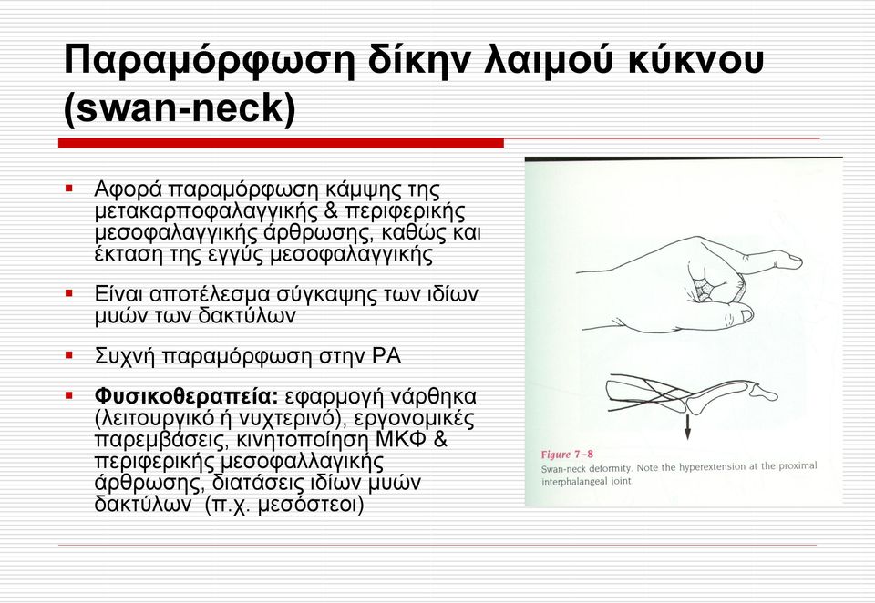 ησλ δαθηύισλ πρλή παξακόξθσζε ζηελ ΡΑ Φπζηθνζεξαπεία: εθαξκνγή λάξζεθα (ιεηηνπξγηθό ή λπρηεξηλό), εξγνλνκηθέο