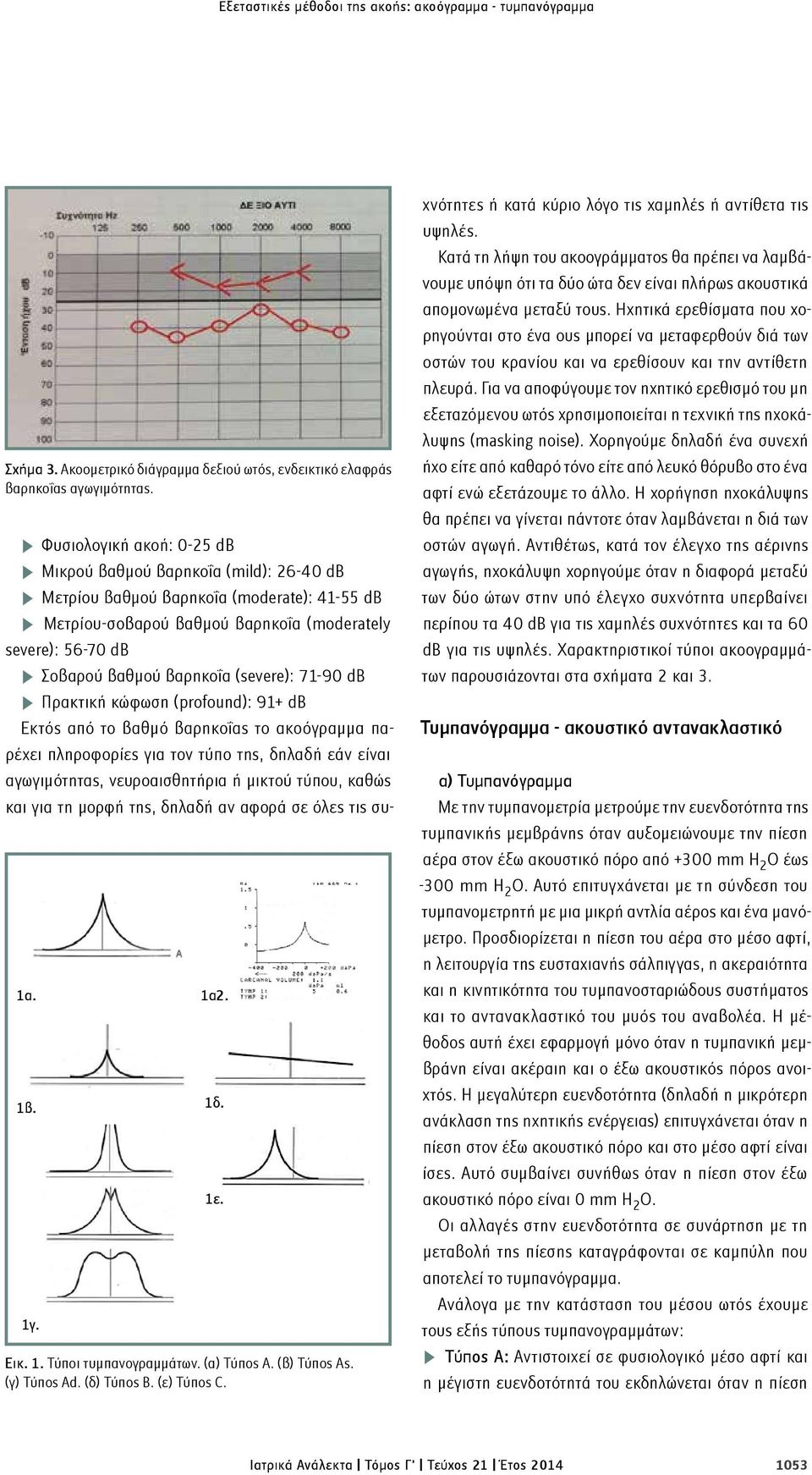 n Φυσιολογική ακοή: 0-25 db n Μικρού βαθμού βαρηκοΐα (mild): 26-40 db n Μετρίου βαθμού βαρηκοΐα (moderate): 41-55 db n Μετρίου-σοβαρού βαθμού βαρηκοΐα (moderately severe): 56-70 db n Σοβαρού βαθμού