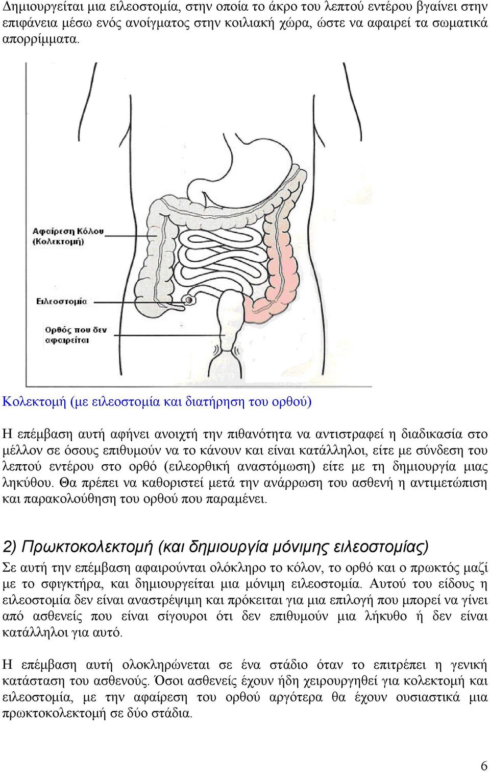 σύνδεση του λεπτού εντέρου στο ορθό (ειλεορθική αναστόµωση) είτε µε τη δηµιουργία µιας ληκύθου.