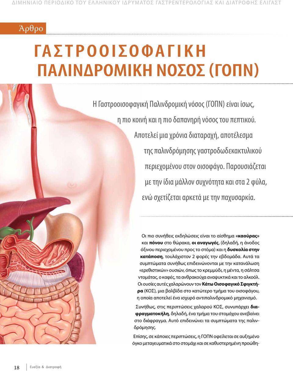 Παρουσιάζεται με την ίδια μάλλον συχνότητα και στα 2 φύλα, ενώ σχετίζεται αρκετά με την παχυσαρκία.