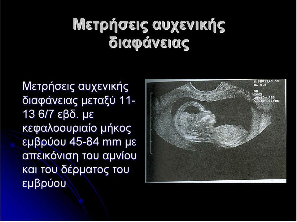 µε κεφαλοουριαίο µήκος εµβρύου 45-84 mm µε