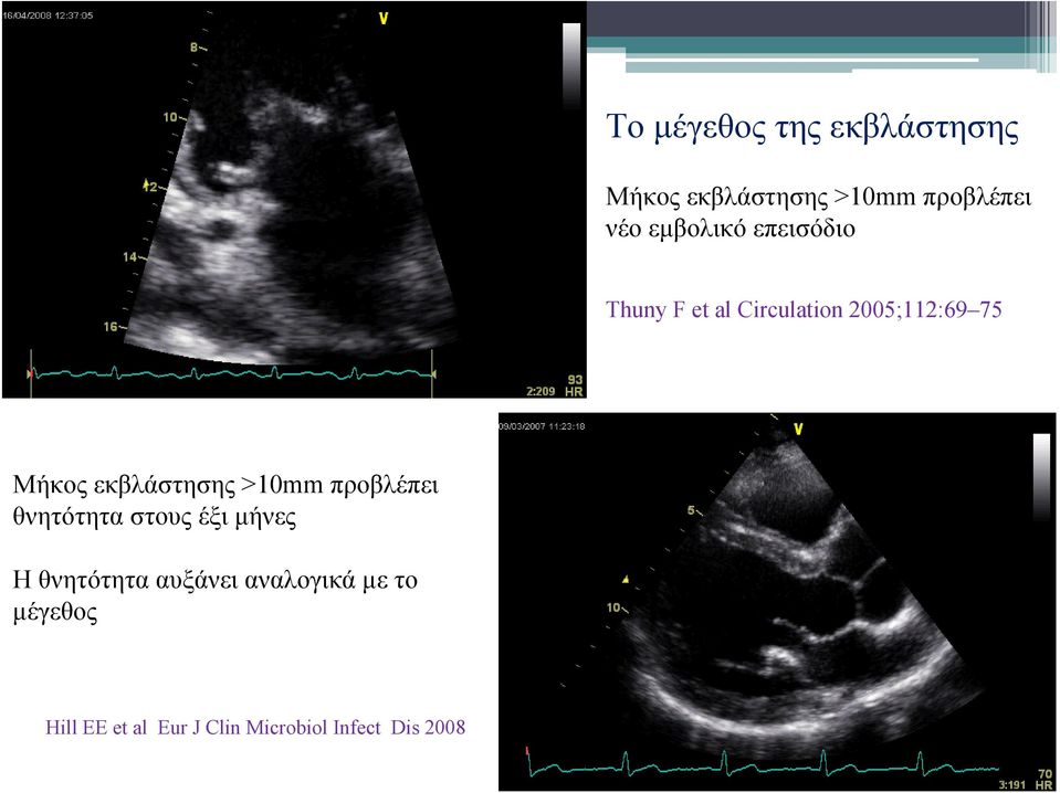 εκβλάστησης >10mm προβλέπει θνητότητα στους έξι μήνες Η θνητότητα