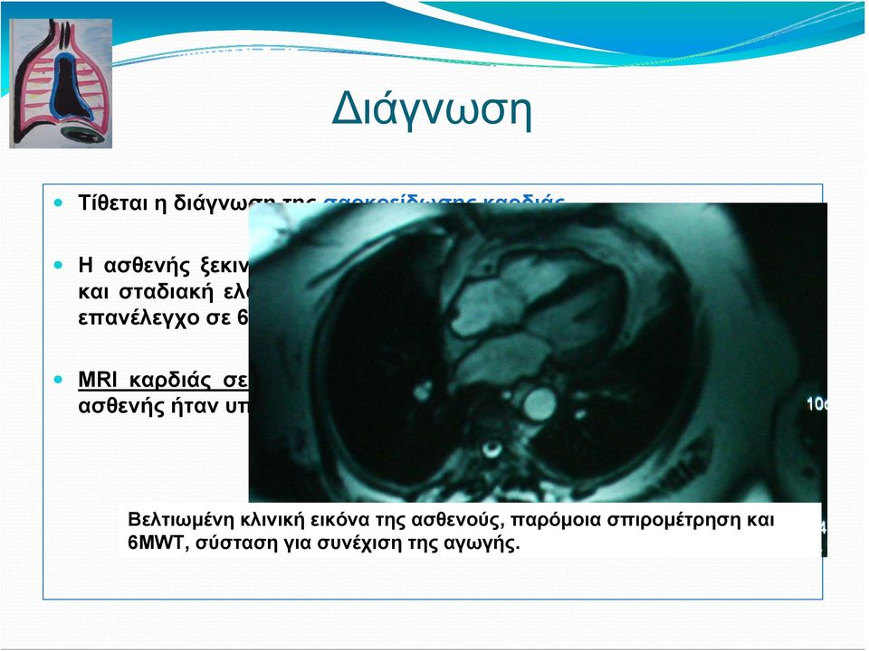 της, με οδηγία για επανέλεγχο σε 6 μήνες. MRI καρδιάς σε 6 μήνες: Χωρίς παθολογικά ευρήματα, EF:58.