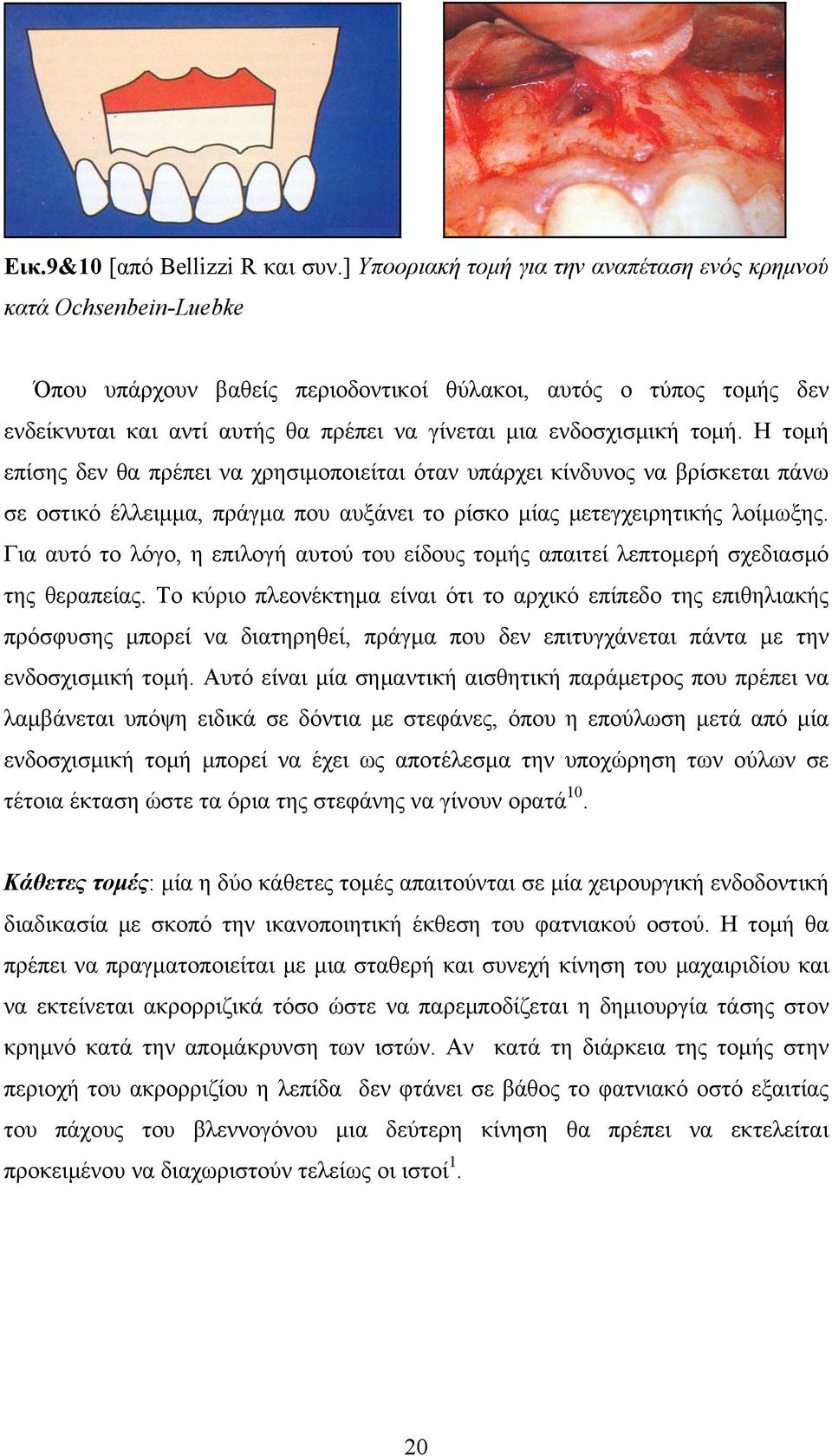 ενδοσχισμική τομή. Η τομή επίσης δεν θα πρέπει να χρησιμοποιείται όταν υπάρχει κίνδυνος να βρίσκεται πάνω σε οστικό έλλειμμα, πράγμα που αυξάνει το ρίσκο μίας μετεγχειρητικής λοίμωξης.