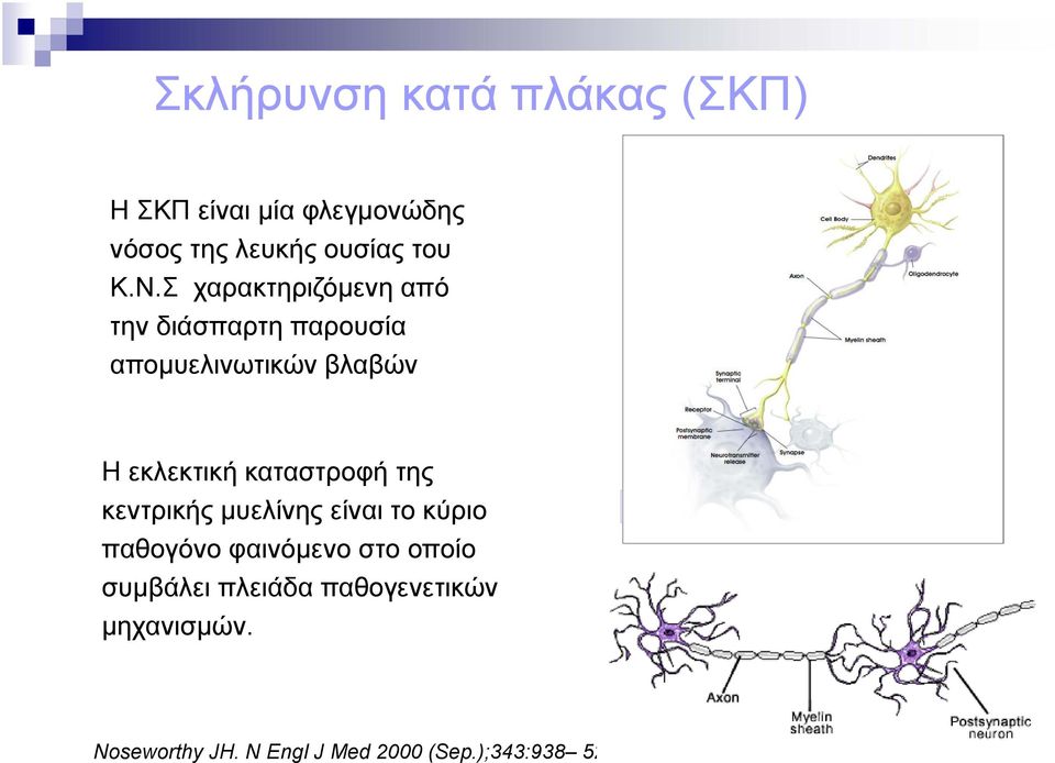 καταστροφή της κεντρικής μυελίνης είναι το κύριο παθογόνο φαινόμενο στο οποίο