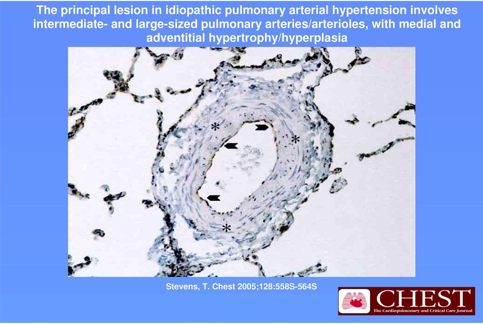 pulmonary arteries/arterioles, with medial and