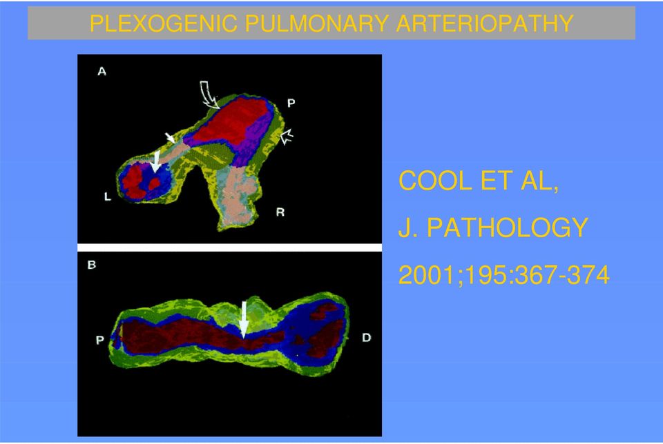 ARTERIOPATHY COOL