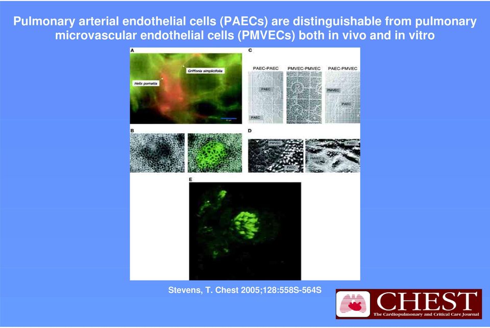 microvascular endothelial cells (PMVECs) both