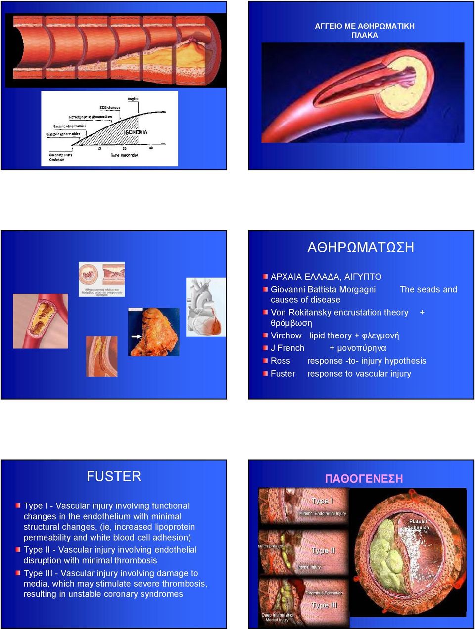 changes in the endothelium with minimal structural changes, (ie, increased lipoprotein permeability and white blood cell adhesion) Type II - Vascular injury involving