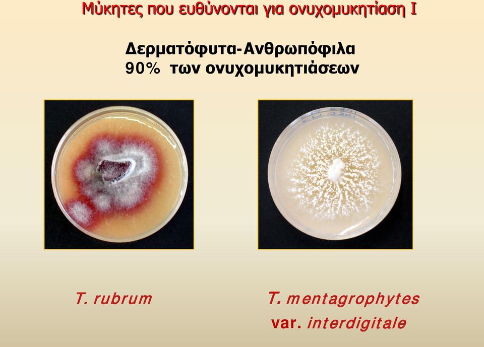 Δερματόφυτα-Ανθρωπόφιλα 90% των