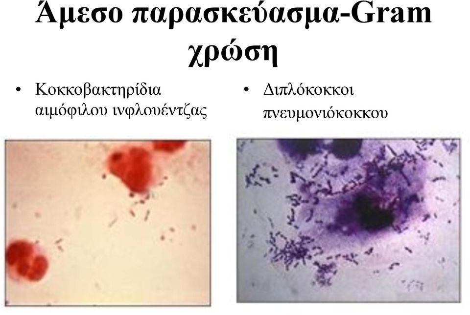αιµόφιλου ινφλουέντζας
