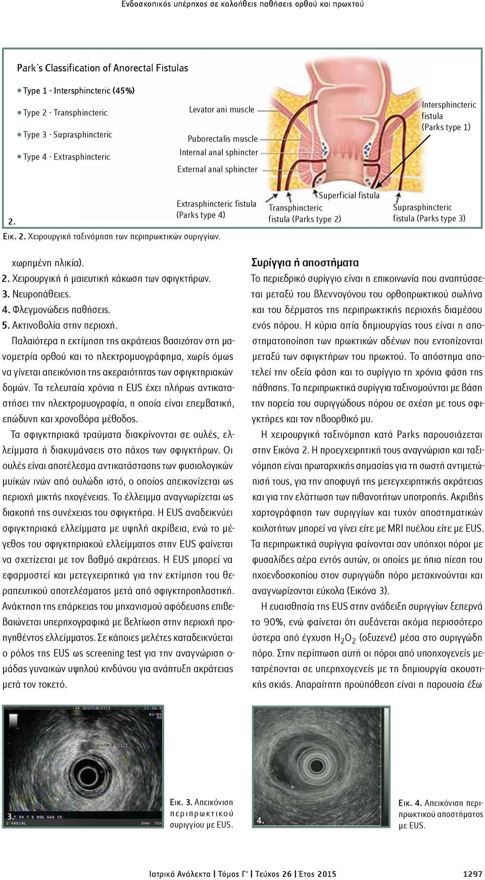 2. Χειρουργική ταξινόμηση των περιπρωκτικών συριγγίων. Superficial fistula Transphincteric fistula (Parks type 2) Suprasphincteric fistula (Parks type 3) χωρημένη ηλικία). 2. Χειρουργική ή μαιευτική κάκωση των σφιγκτήρων.