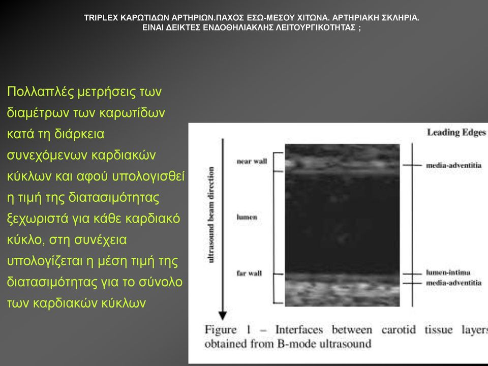 δηαηαζηκόηεηαο μερσξηζηά γηα θάζε θαξδηαθό θύθιν, ζηε ζπλέρεηα