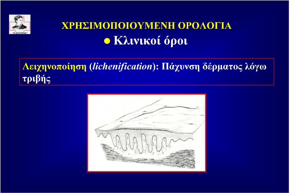 (lichenification):