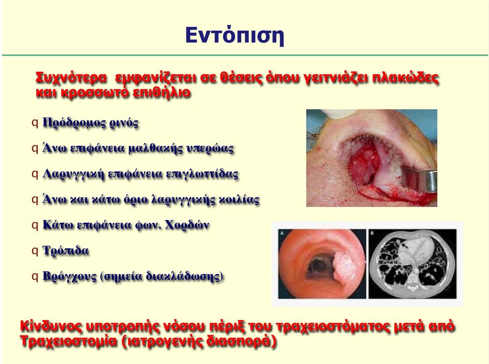 κάτω όριο λαρυγγικής κοιλίας q Κάτω επιφάνεια φων.