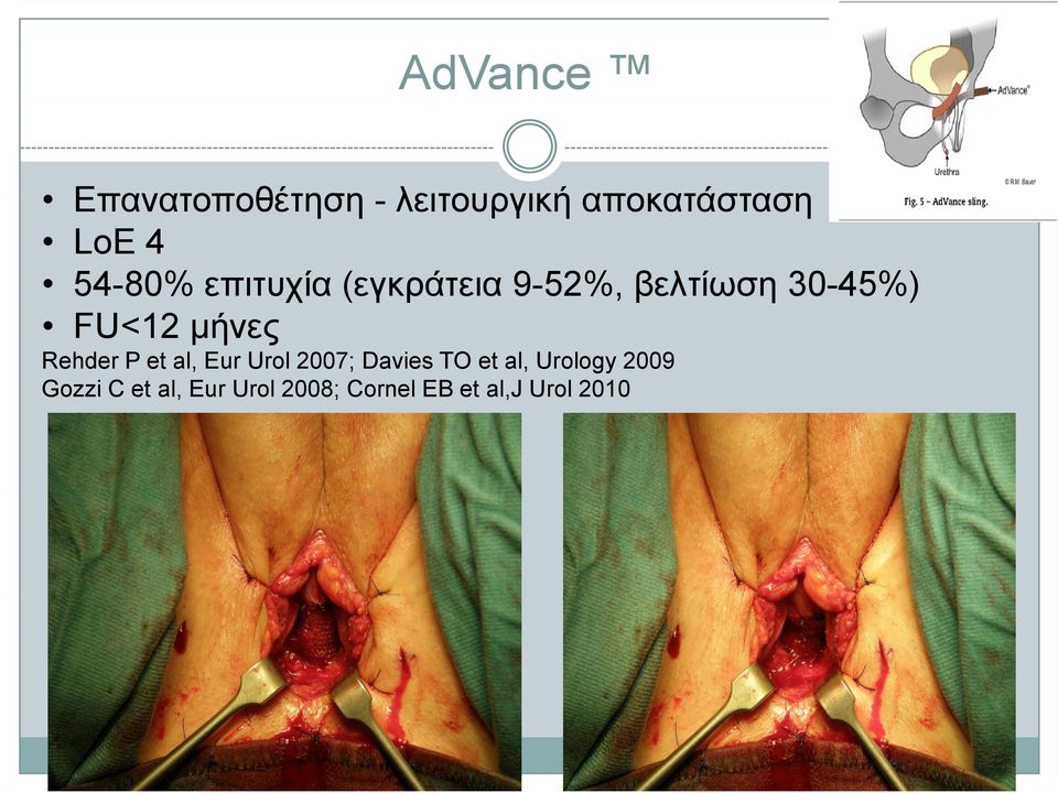 μήνες Rehder P et al, Eur Urol 2007; Davies TO et al,