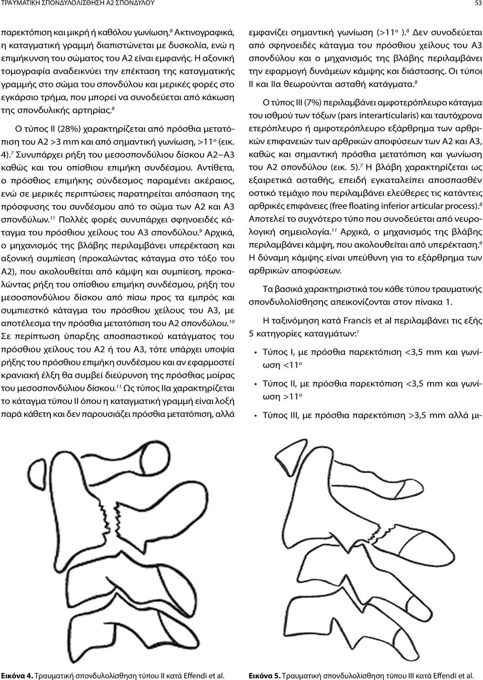 8 Ο τύπος ΙΙ (28%) χαρακτηρίζεται από πρόσθια μετατόπιση του Α2 >3 mm και από σημαντική γωνίωση, >11 ο (εικ. 4).