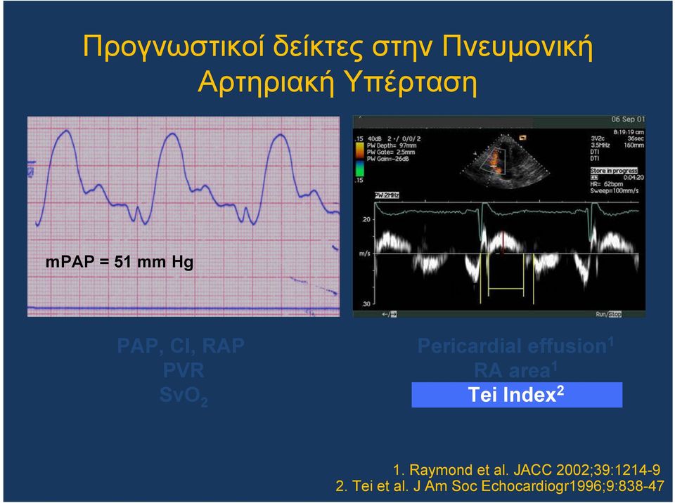 effusion 1 RA area 1 Tei Index 2 1. Raymond et al.