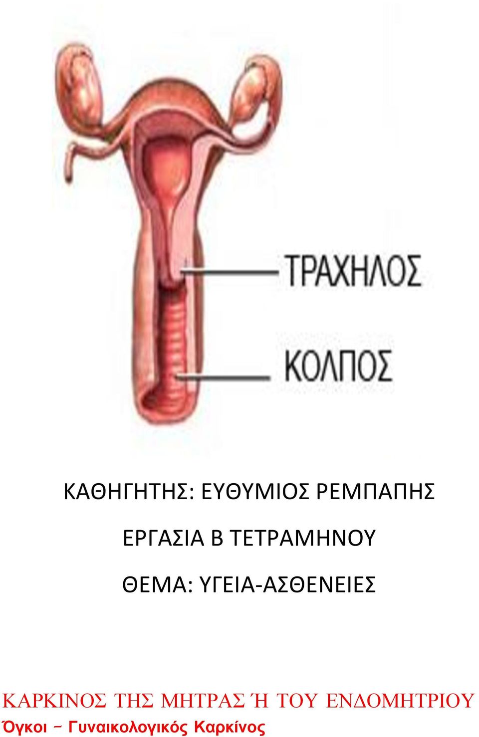 ΥΓΕΙΑ-ΑΣΘΕΝΕΙΕΣ ΚΑΡΚΙΝΟΣ ΤΗΣ ΜΗΤΡΑΣ