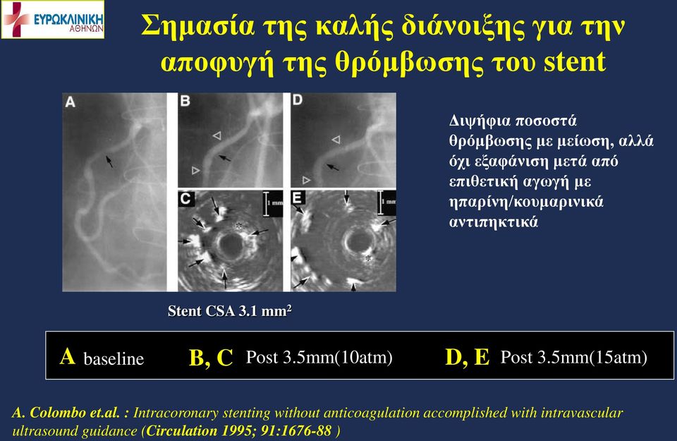 1 mm 2 A baseline B, C Post 3.5mm(10atm) D, E Post 3.5mm(15atm) A. Colombo et.al.