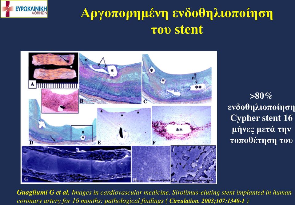 Images in cardiovascular medicine.