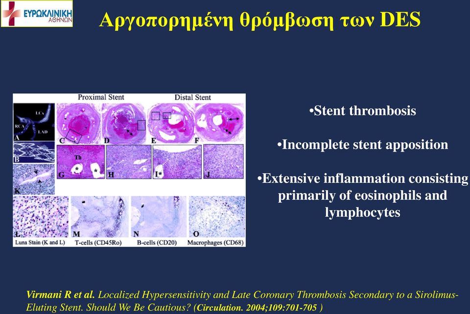 Virmani R et al.